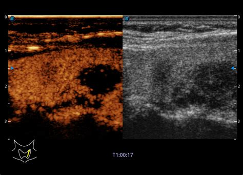 P60 | Intelligence Articulated | Sonoscape India