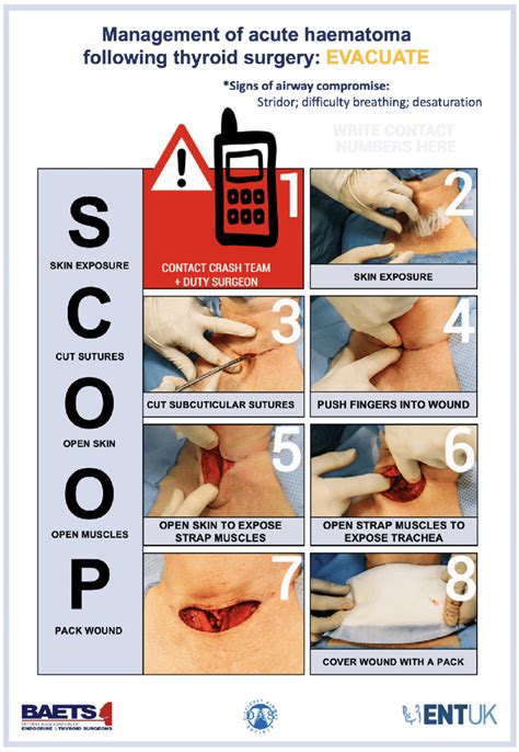 Image result for Das Difficult Airway Algorithm