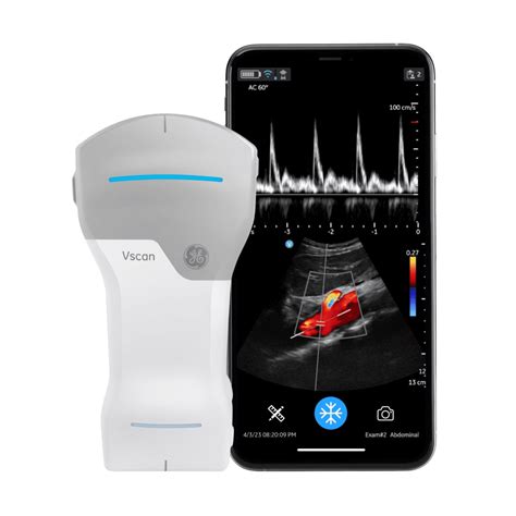 GE Vscan Air CL Handheld Ultrasound System - New | Marcroft Medical