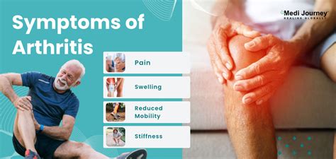 Artritis 101: comprensión de los diferentes tipos y tratamientos