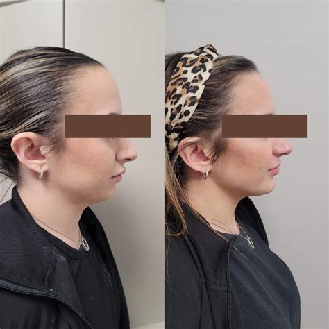 Eyebrow Threading Training 的图像结果