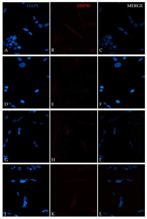 CT2A Cell Viability Modulated by Electromagnetic Fields at Extremely ...