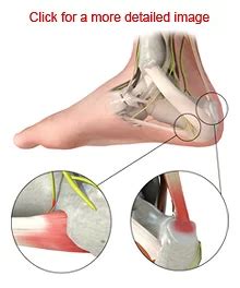 rljhrc-Orthopedics-Patient-Education-Material