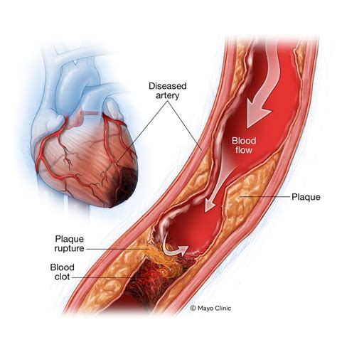 How To Draw A Heart Muscle