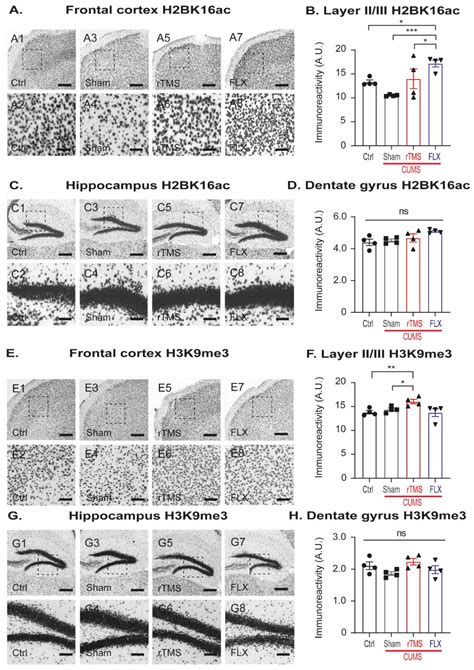 Repetitive Transcranial Magnetic Stimulation Reduces Depressive-like ...