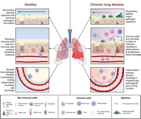 Frontiers | Pseudomonas aeruginosa in chronic lung disease: untangling the dysregulated host ...