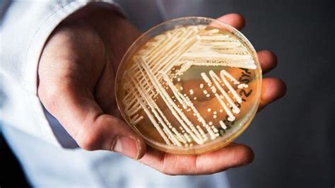 科学家研究发现新冠肺炎可促进耐药“超级真菌”的传播_东方养生频道_东方养生