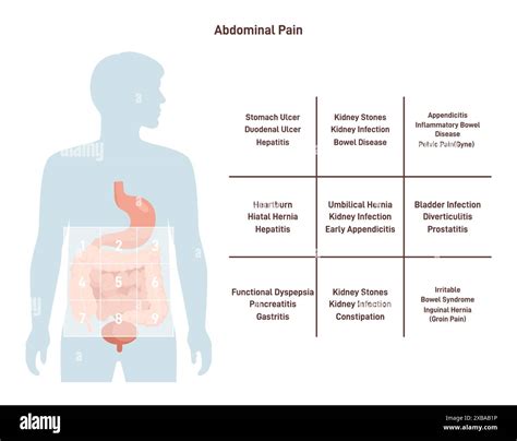 Abdominal ache map. Medical infographic or self-help guide. Spasm and ...