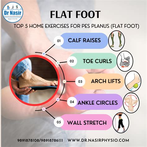 Flat Feet Treatment in Delhi | 9891878108 Dr Nasir Physiotherapy