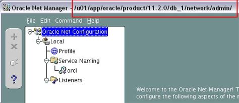 Image result for Oracle Net Manager Problem