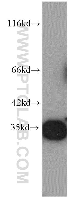 RPS3 antibody (66046-1-Ig) | Proteintech