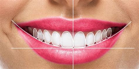 Smile Designing | Gupta Dental Clinic