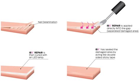 IBX Nail Strengthening Repair Treatment