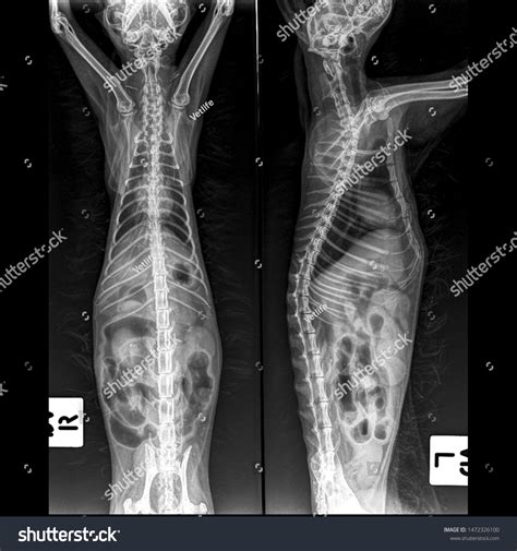 X Ray Pneumonia Cat Both View Stock Photo (Edit Now) 1472326100