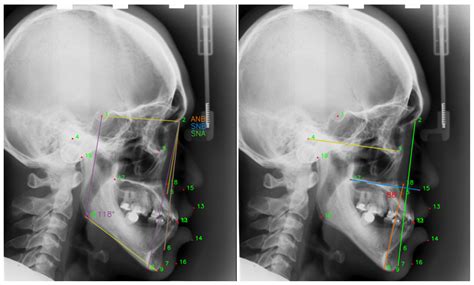 An Intelligent Shooting Reward Learning Network Scheme for Medical ...