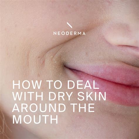 Dry Skin Around Mouth