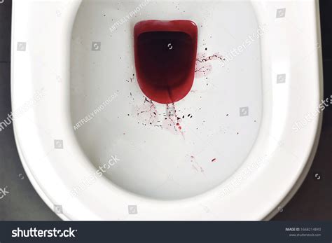 Bright Red Blood In Toilet