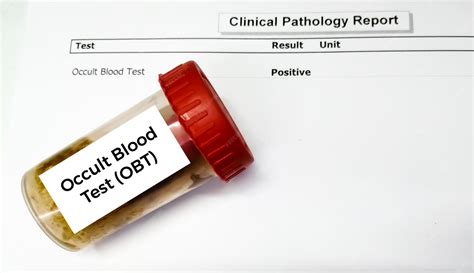 Premium Photo | Occult blood test (obt) with abnormal patient's report.
