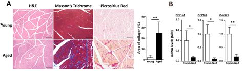 Aged Skeletal Muscle Retains the Ability to Remodel Extracellular ...