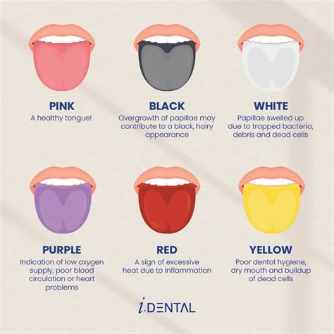 What Does Your Tongue Colour Mean?