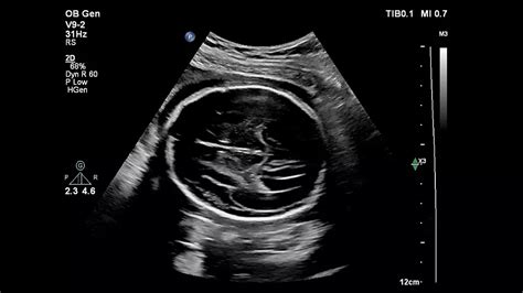 Philips-Compact-5300-Series-premium-compact-ultrasound-system