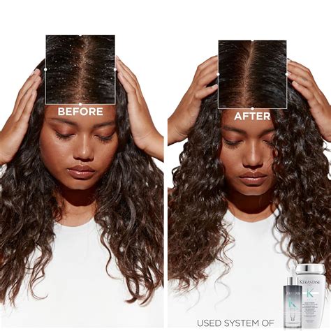 KERASTASE Symbiose Anti Dandruff Shampoo Crème | Cleanses and Hydrates ...