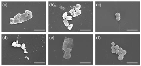 Antibacterial Gelatin Composite Hydrogels Comprised of In Situ Formed ...