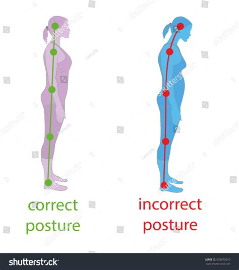 Image result for Posture From Back View Alignment