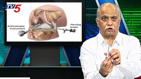 మోకాలి నొప్పులకు ఆర్థ్రోస్కోపిక్ సర్జరీ | ఓమ్ని హాస్పిటల్స్ | OMNI ...