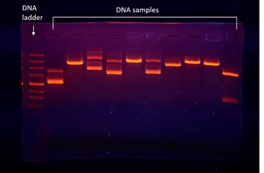 Name and explain the technique that helps in the separation of DNA ...