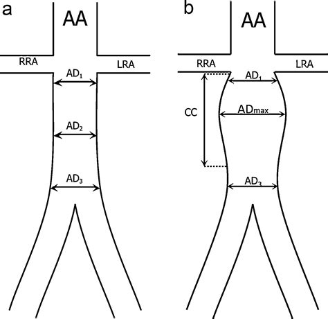 Anteroposterior Diameter