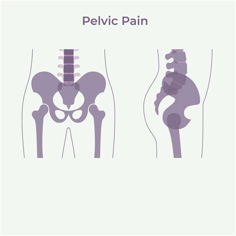 Pelvic Pain | West Sussex Gynaecology