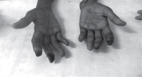 Latest Clinical Journal | Reviews | Medical Research | Guidelines | IJCP