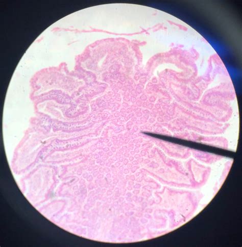 Image result for Small Intestine Jejunum