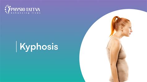 Managing Kyphosis: Symptoms, Causes & Treatment Guide