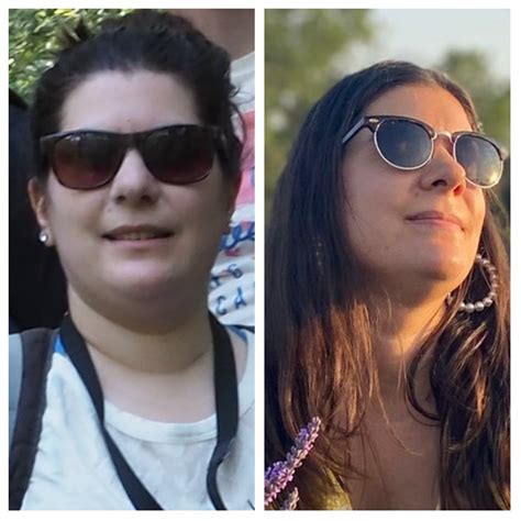 Face gains. Goodbye, neck fat and sleep apnea! F 5'5 (168 cm) SW 87 kg ...
