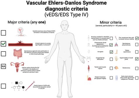 Frontiers | Case report: A novel COL3A1 variant in a Colombian patient with isolated ...