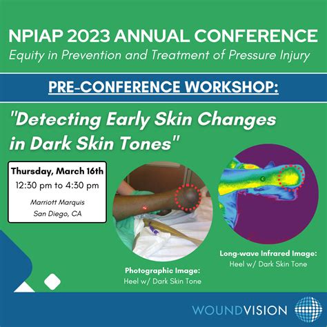 Pressure Injury Assessment - Detecting Early Changes in Dark Skin