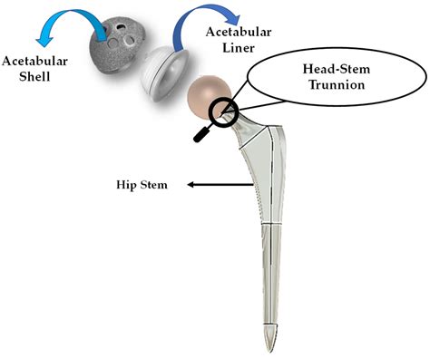 Design and Performance Evaluation of a Novel Spiral Head-Stem Trunnion ...