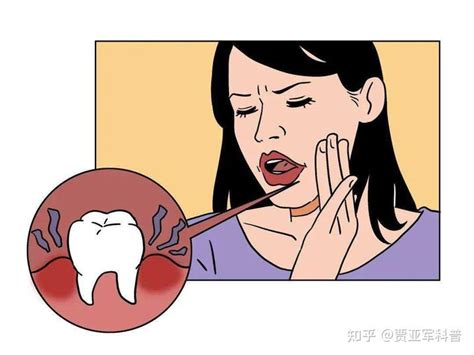 牙疼不是病，疼起来真要命，用甲硝唑没用？医生教你一招解决它 - 知乎