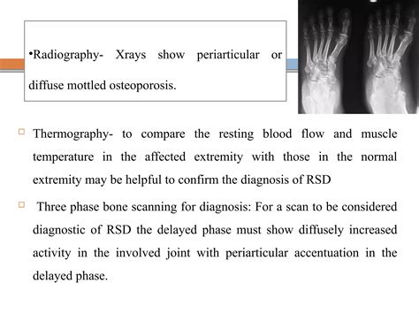 Reflex symapathetic dystrophy | PDF