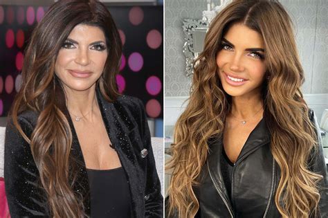 Teresa Giudice Face Surgery