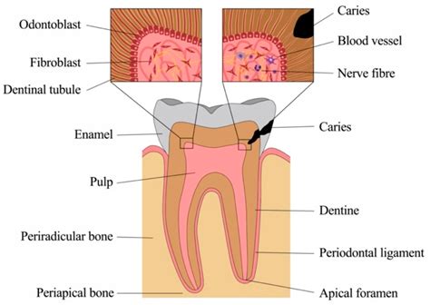 Inflammatory Response Mechanisms of the Dentine–Pulp Complex and the ...