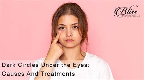 Dark Circles Under the Eyes: Causes And Treatments