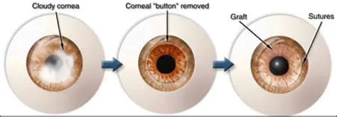 Uma eye clinic