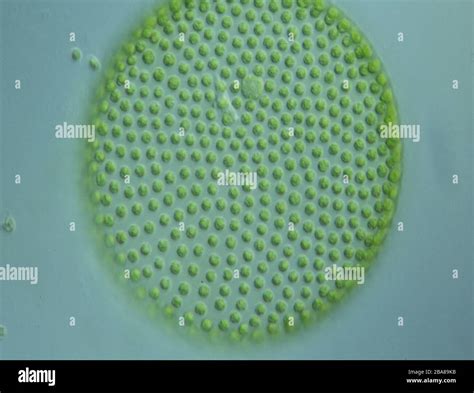 Volvox Under Microscope 100x Labeled