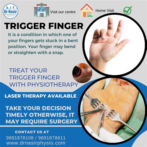 What Is The Treatment For Trigger Finger at Andrea Cahill blog