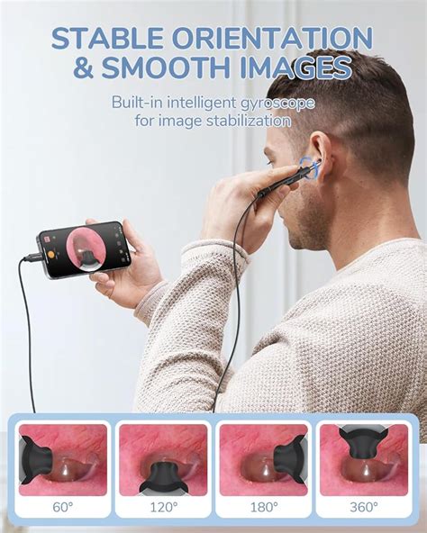 ScopeAround Otoscope with Light, 1080P FHD Ear India | Ubuy