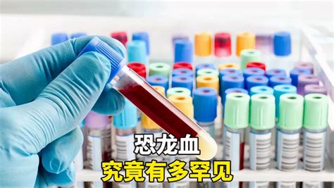 大众科普——网传＂恐龙血＂究竟是怎样的一种血型？-中国输血协会