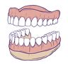 Dental Implants Types, Procedure & Cost in India | Dezy
